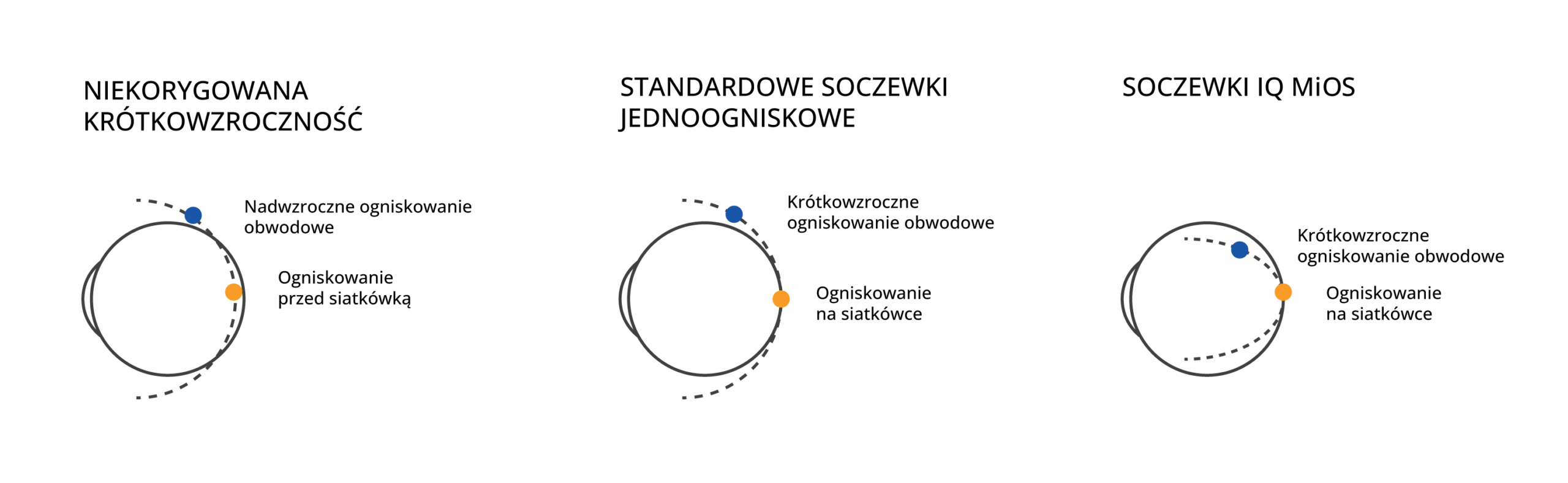 kontrola-krotkowzrocznosci-1a
